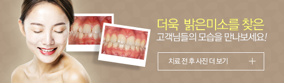 더욱 밝은미소를 찾은 고객님들의 모습을 만나보세요