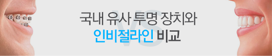 일반 설측장치와 인코그니토 비교
